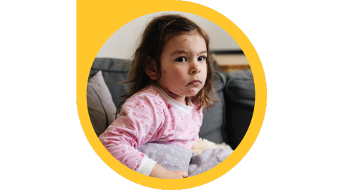 A sad child in pajamas with small red bumps on their face sits on a couch holding pillows.