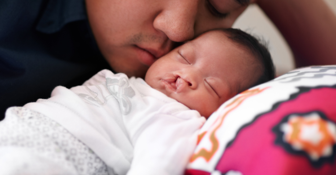 A man lays beside a baby with a cleft lip.