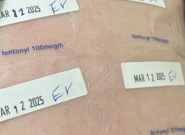 Clear plastic patches on skin that say fentanyl 100mcg/h with white stickers marked Mar 12 2025 EV